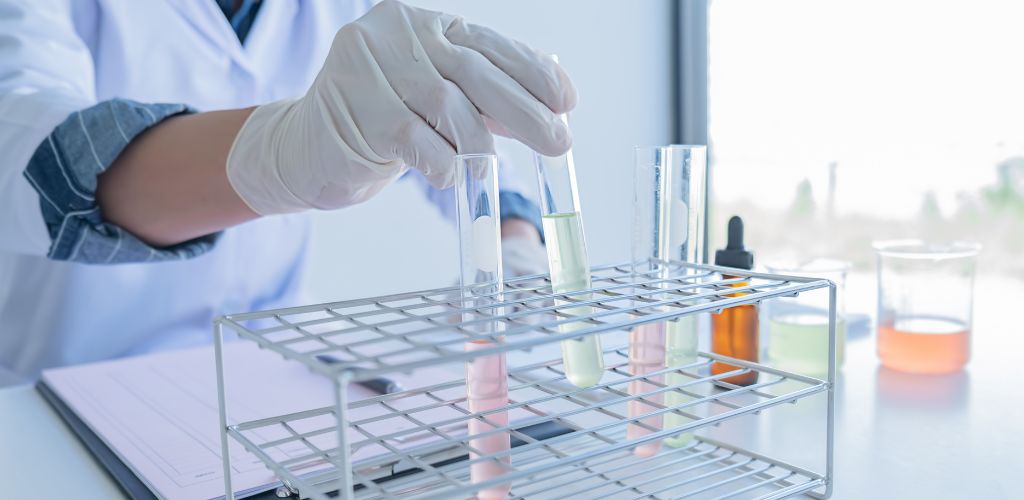 Best MicroAlbumin Tests
